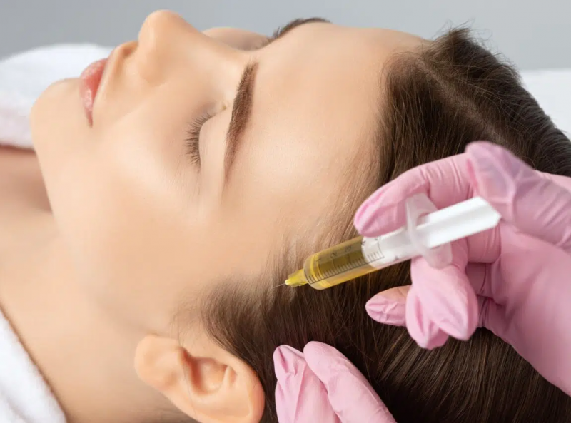 Close-up of a woman receiving a hair treatment injection from a gloved hand.